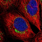 Immunofluorescent staining of human cell line A-431 shows localization to mitochondria.