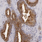Immunohistochemical staining of human prostate shows strong membranous-cytoplasmic positivity in glandular cells.