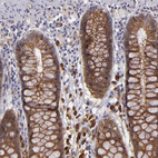 Anti-SYTL4 Antibody