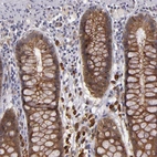 Immunohistochemical staining of human lower rectum shows strong membranous-cytoplasmic positivity in glandular cells.