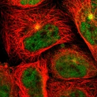 Immunofluorescent staining of human cell line A-431 shows localization to nucleoplasm, cytosol & microtubule organizing center.