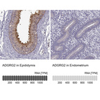 Anti-ADGRG2 Antibody