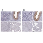 Immunohistochemical staining of human endometrium, epididymis, liver and skeletal muscle using Anti-ADGRG2 antibody HPA001478 (A) shows similar protein distribution across tissues to independent antibody HPA050029 (B).