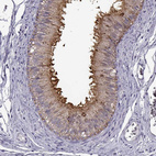 Immunohistochemical staining of human epididymis shows strong positivity in microvilli in glandular cells.