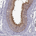 Anti-ADGRG2 Antibody