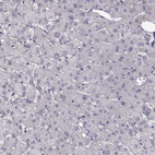 Anti-ADGRG2 Antibody