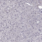 Immunohistochemical staining of human liver shows no positivity in hepatocytes as expected.