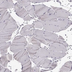 Immunohistochemical staining of human skeletal muscle shows no positivity in myocytes as expected.