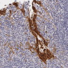 Anti-IL1RN Antibody