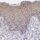 Immunohistochemical staining of human skin shows weak to moderate positivity in squamous epithelial cells.