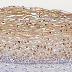 Immunohistochemical staining of human cervix, uterine shows moderate positivity in squamous epithelial cells.