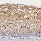 Immunohistochemical staining of human cervix, uterine shows moderate positivity in squamous epithelial cells.
