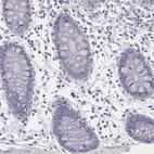 Anti-IL1RN Antibody