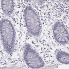Immunohistochemical staining of human colon shows no positivity in glandular cells as expected.