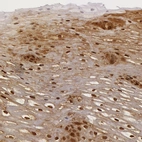 Immunohistochemical staining of human esophagus shows moderate to strong positivity in squamous epithelial cells.