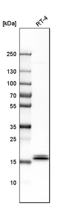 Western blot analysis in human cell line RT-4.