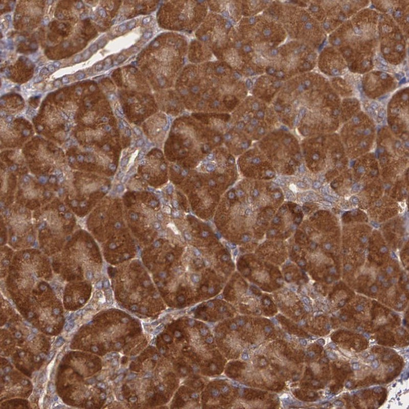 Anti-ECE1 Antibody