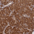 Anti-ECE1 Antibody