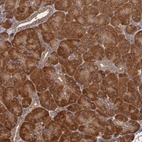 Anti-ECE1 Antibody