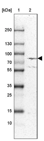 Lane 1: Marker [kDa] 250, 130, 100, 70, 55, 35, 25, 15, 10_br/_Lane 2: Human cell line U-87 MG