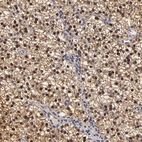 Immunohistochemical staining of human parathyroid gland shows high expression.