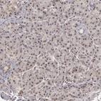 Immunohistochemical staining of human pancreas shows low expression as expected.