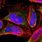 Immunofluorescent staining of human cell line U-2 OS shows localization to vesicles.
