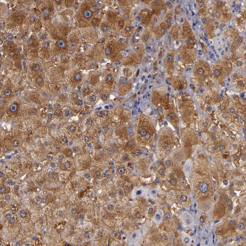 Anti-ZNF229 Antibody