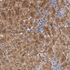 Anti-ZNF229 Antibody