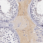 Immunohistochemical staining of human testis shows weak positivity in plasma.