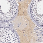 Immunohistochemical staining of human testis shows weak positivity in plasma.