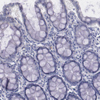 Immunohistochemical staining of human colon shows no cytoplasmic positivity in glandular cells as expected.