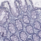 Immunohistochemical staining of human colon shows no cytoplasmic positivity in glandular cells as expected.