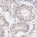 Anti-ZBTB16 Antibody