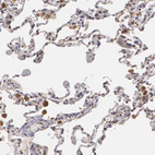 Anti-ZBTB16 Antibody