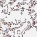 Immunohistochemical staining of human Lung shows moderate nuclear positivity in macrophages.