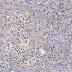 Anti-ZBTB16 Antibody