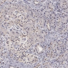 Immunohistochemical staining of human Pancreas shows weak nuclear positivity in exocrine glandular cells.