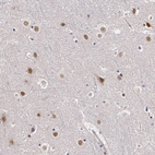 Immunohistochemical staining of human Cerebral cortex shows moderate nuclear positivity in neuronal cells.