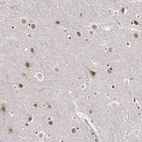 Anti-ZBTB16 Antibody