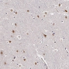 Immunohistochemical staining of human Cerebral cortex shows moderate nuclear positivity in neuronal cells.
