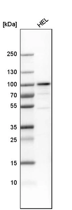 Western blot analysis in human cell line HEL.