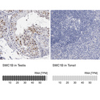 Anti-SMC1B Antibody