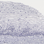 Anti-SMC1B Antibody