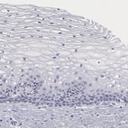Immunohistochemical staining of human cervix, uterine shows no positivity in squamous epithelial cells as expected.