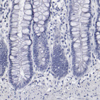 Anti-SMC1B Antibody