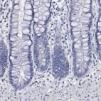 Immunohistochemical staining of human rectum shows no positivity in glandular cells as expected.