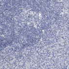Anti-SMC1B Antibody