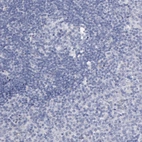 Immunohistochemical staining of human tonsil shows no positivity in lymphoid cells.