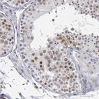 Immunohistochemical staining of human testis shows moderate to strong nuclear positivity in cells in seminiferous ducts.